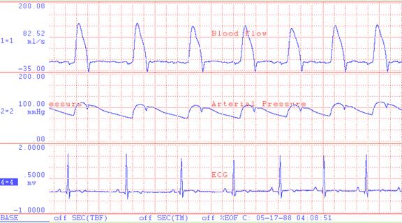 The Electrocardiogram And Cardiac Pulse do-not-be-noise-sign-11354318-vector-art-at-vecteezy